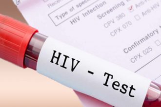 Early detection of HIV