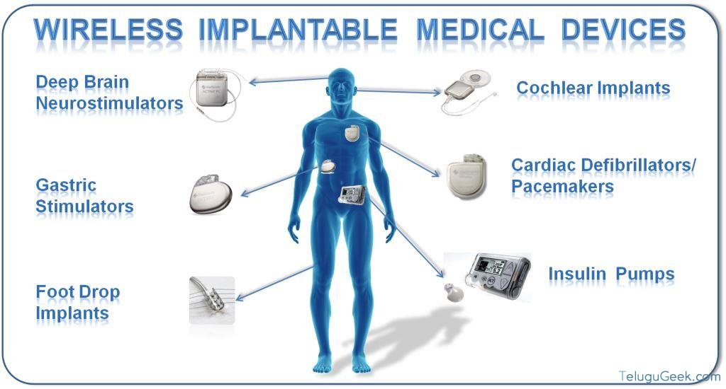 ఈ medical implants ద్వారా మన శరీరం లోనుంచీ HD data transfer సాధ్యం