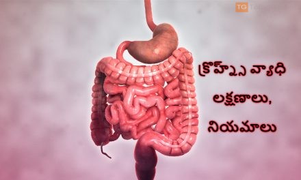 క్రొహ్న్స్ వ్యాధి – లక్షణాలు, నియమాలు