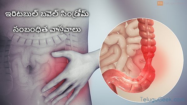 ఇరిటబుల్ బవెల్ సిండ్రోమ్ – సంబంధిత వాస్తవాలు