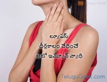 ల్యూపస్ దీర్ఘకాలం వేధించే ఆటో ఇమ్యూన్ వ్యాధి